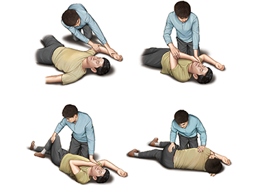 가슴압박 소생술을 시행하던 중에 환자가 소리를 내거나 움직이면, 호흡도 회복되었는지 확인한다. 호흡이 회복되었다면, 환자를 옆으로 돌려 눕혀 기도(숨길)가 막히는 것을 예방한다. 그 후 환자의 반응과 호흡을 관찰해야 한다. 환자의 반응과 정상적인 호흡이 없어진다면 심정지가 재발한 것이므로 신속히 가슴압박과 인공호흡을 다시 시작한다.